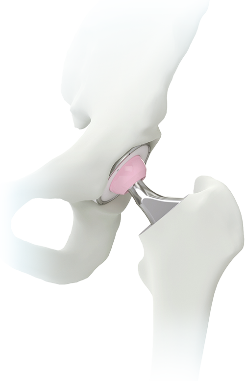 ../../image/box-home-med-mini-spine.png